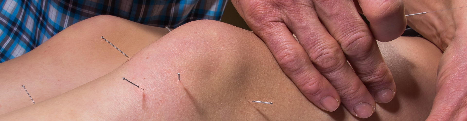 dry-needling-Complete-Game-Physical-Therapy-North-Chelmsford-MA-1920x500